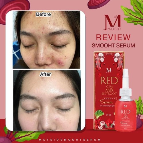 Red GEM Mix Beetroot Smooth Serum Main Image